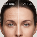 MultiSal® Retinol