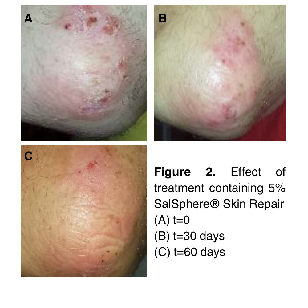 SalSphere® Skin Repair