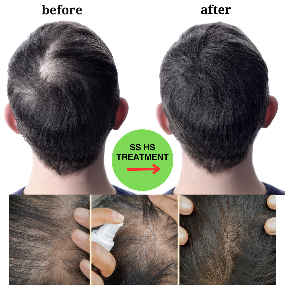 SalSphere® Hair Stimulator