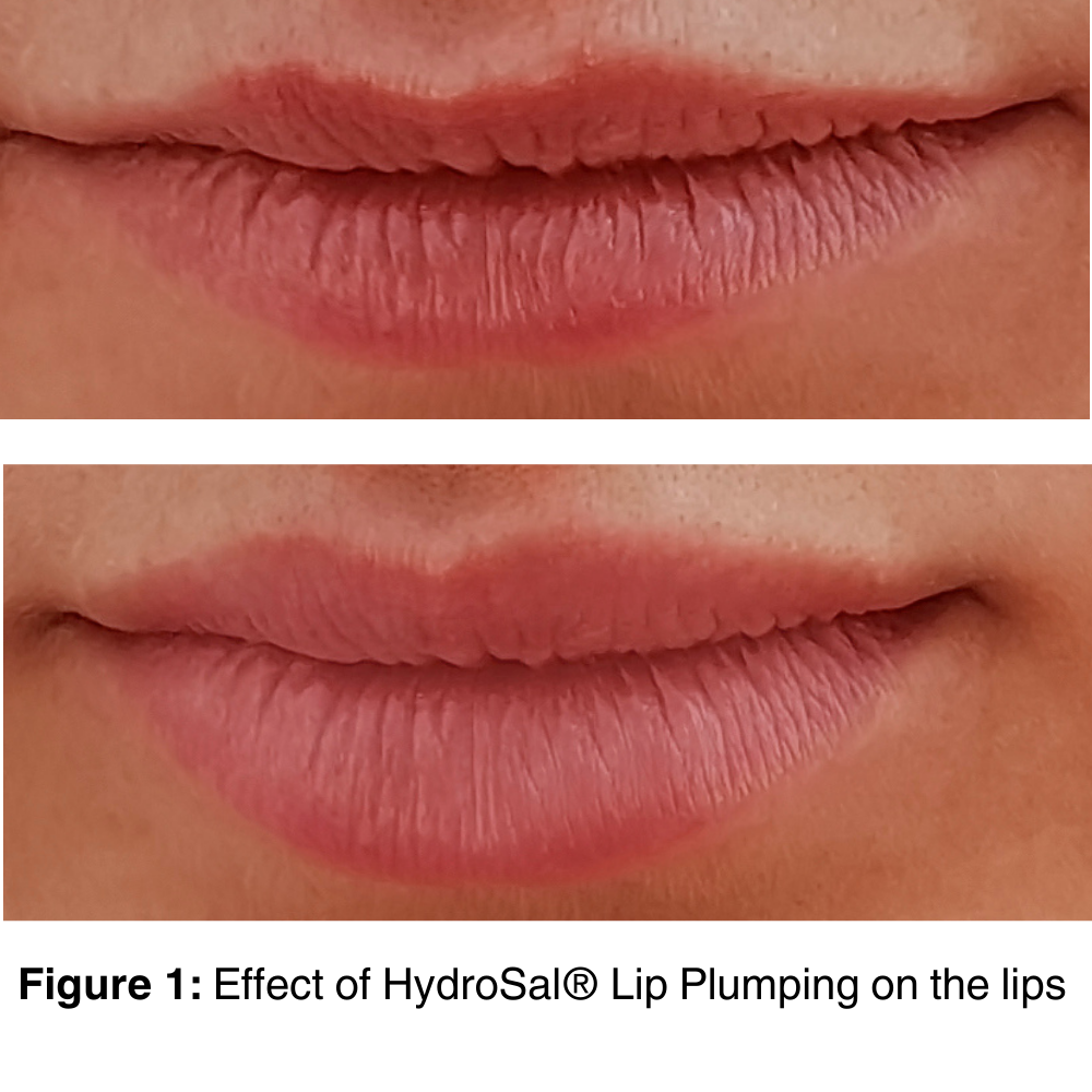 HydroSal® Lip Plumping