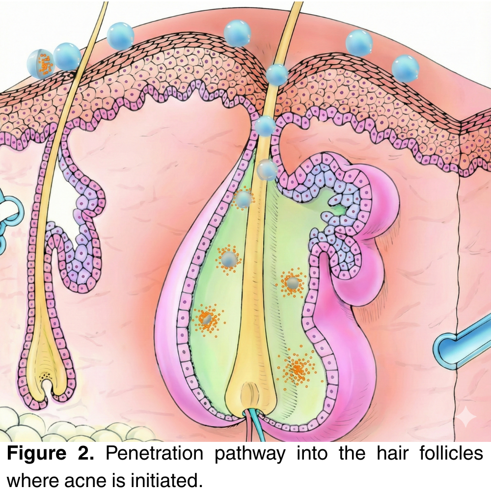 SalSphere® Benzoyl Peroxide (BPO)