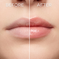 HydroSal® Lip Plumping