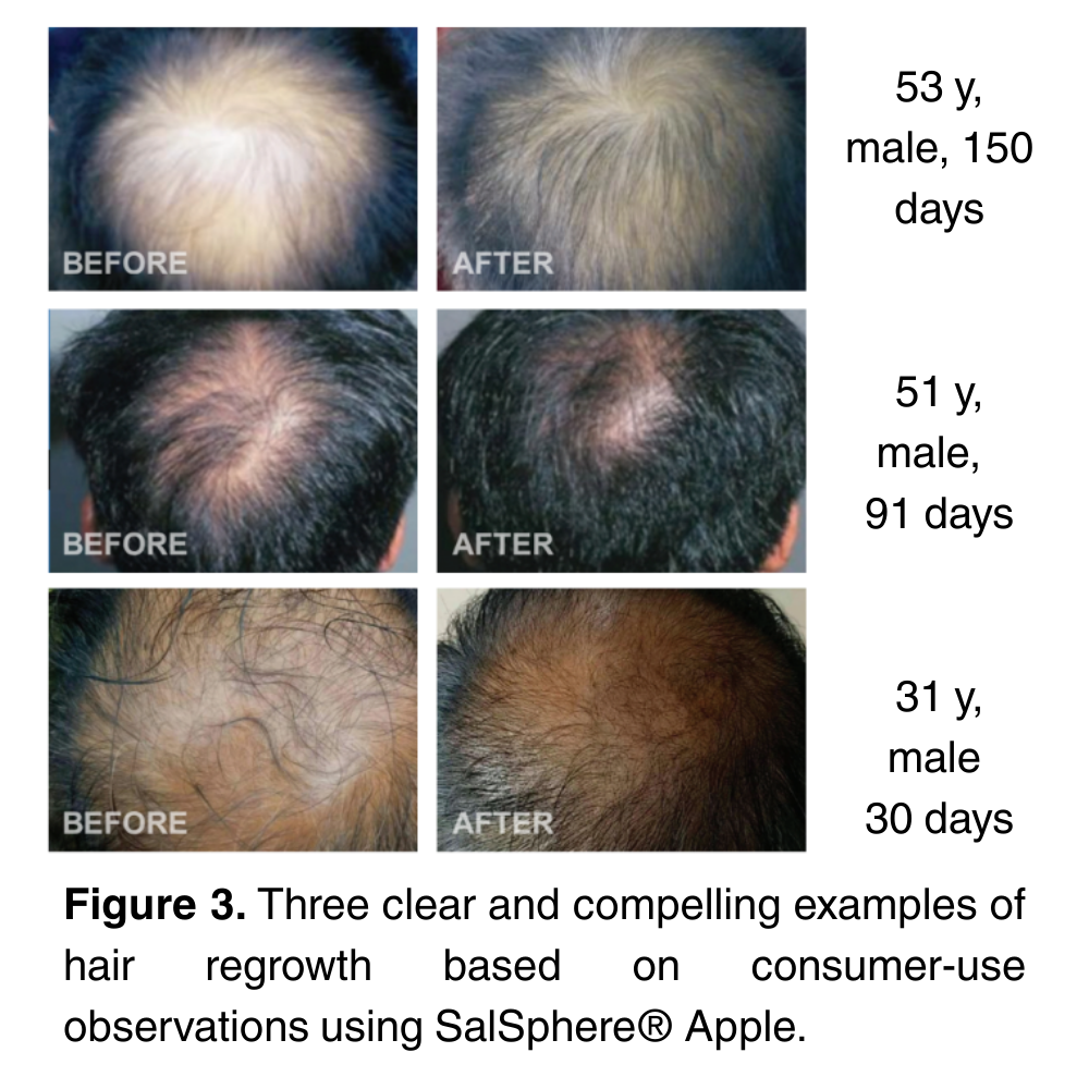 SalSphere® Apple (Natural Hair Growth Promoter)