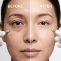 SalSphere® Aqua Skin