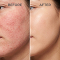 SalSphere® Skin Repair