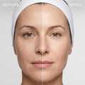 Before and after comparison of a woman's face with a white headband on a light gray background.