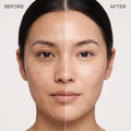 Before and after comparison of a woman's face with visible skin improvement.