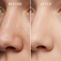 Before and after comparison of a person's nose with visible skin texture changes.
