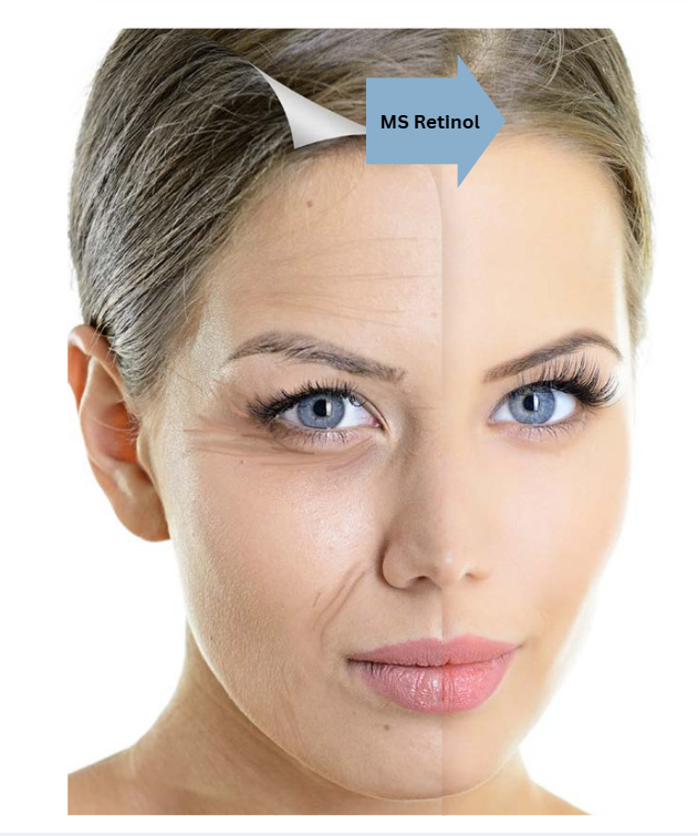 MultiSal® Retinol