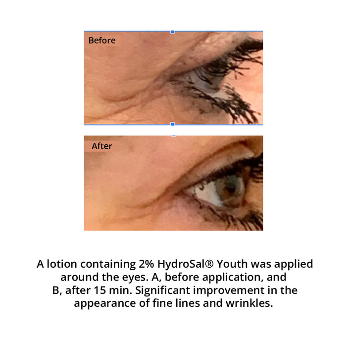 HydroSal® Youth