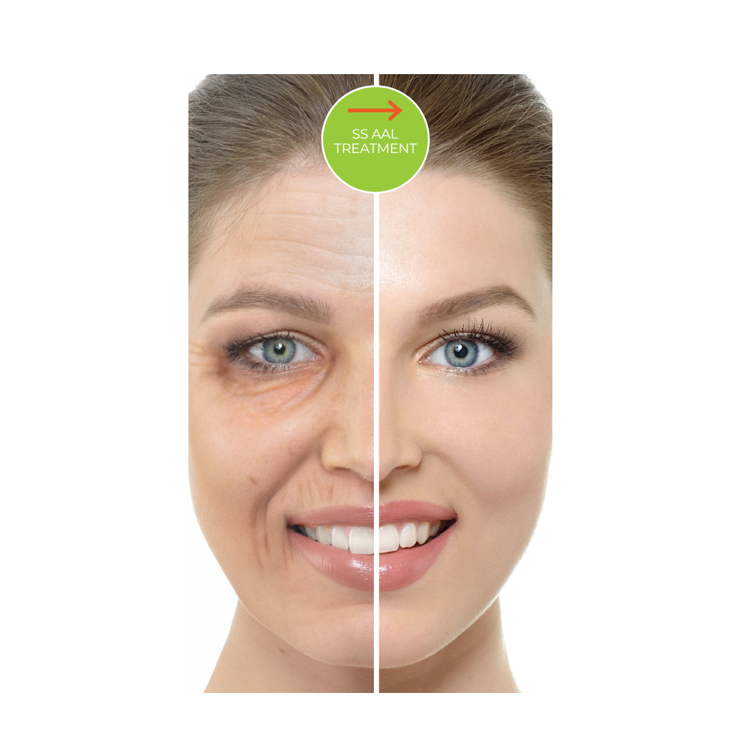 SalSphere® Anti-Aging Lift